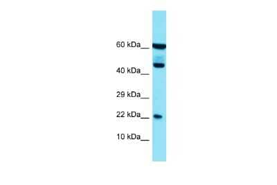 Western Blot: PLA2G12B Antibody [NBP2-85484]