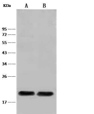 Western Blot: PLA2G12B Antibody [NBP2-99414]