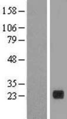 Western Blot: PLA2G12B Overexpression Lysate [NBL1-14470]