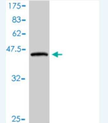 Western Blot: PLA2G16/HRASLS3 Antibody (1B10-2D9) [H00011145-M01]