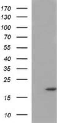 Western Blot: PLA2G16/HRASLS3 Antibody (OTI1A5)Azide and BSA Free [NBP2-73454]