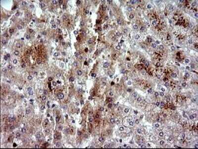 Immunohistochemistry: PLA2G16/HRASLS3 Antibody (OTI1A5) [NBP2-46429]