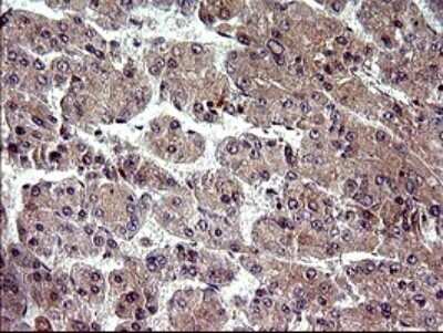 Immunohistochemistry: PLA2G16/HRASLS3 Antibody (OTI1A5) [NBP2-46429]