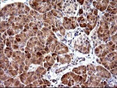 Immunohistochemistry: PLA2G16/HRASLS3 Antibody (OTI1A5) [NBP2-46429]
