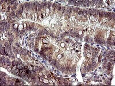 Immunohistochemistry: PLA2G16/HRASLS3 Antibody (OTI1A5) [NBP2-46429]