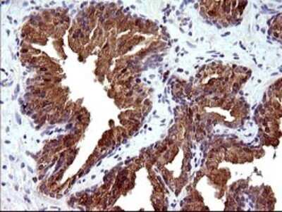 Immunohistochemistry: PLA2G16/HRASLS3 Antibody (OTI1A5) [NBP2-46429]