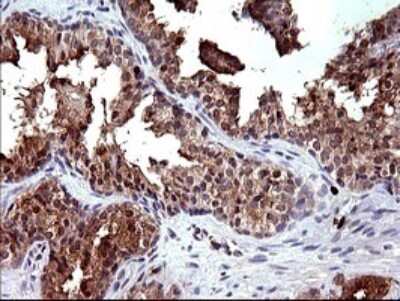 Immunohistochemistry: PLA2G16/HRASLS3 Antibody (OTI1A5) [NBP2-46429]