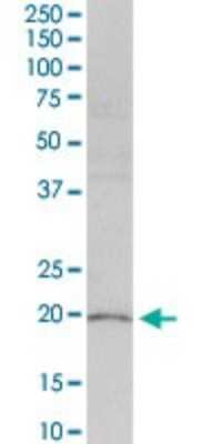 Western Blot: PLA2G16/HRASLS3 Antibody [H00011145-D01P]