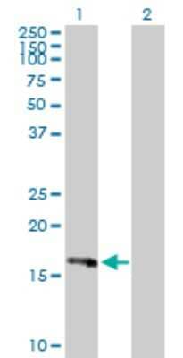 Western Blot: PLA2G16/HRASLS3 Antibody [H00011145-D01P]