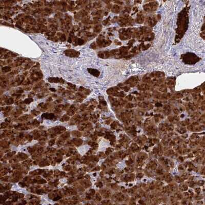 Immunohistochemistry-Paraffin: PLA2G1B Antibody [NBP2-32569]