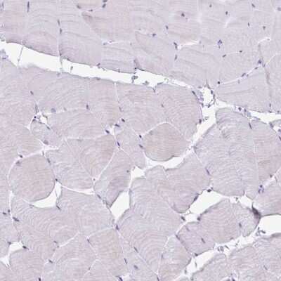 Immunohistochemistry-Paraffin: PLA2G1B Antibody [NBP2-32569]