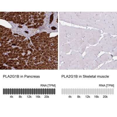 Immunohistochemistry-Paraffin: PLA2G1B Antibody [NBP2-32569]