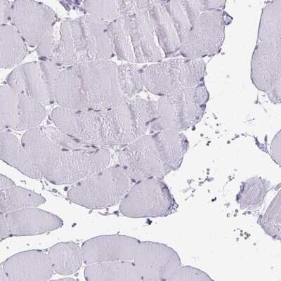 Immunohistochemistry-Paraffin: PLA2G1B Antibody [NBP2-33501]