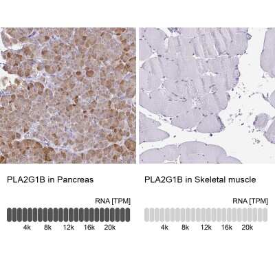 Immunohistochemistry-Paraffin: PLA2G1B Antibody [NBP2-33501]