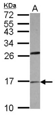 Western Blot: PLA2G1B Antibody [NBP2-15073]