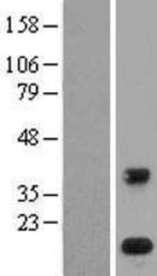 Western Blot: PLA2G1B Overexpression Lysate [NBL1-14471]