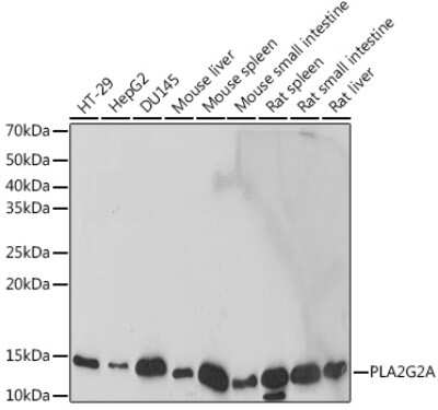 Western Blot: PLA2G2A Antibody (3X9F5) [NBP3-15715]