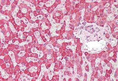 Immunohistochemistry-Paraffin: PLA2G2A Antibody [NBP2-42399]