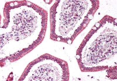 Immunohistochemistry-Paraffin: PLA2G2A Antibody [NBP2-42399]