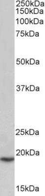 Western Blot: PLA2G2A Antibody [NBP2-42399]