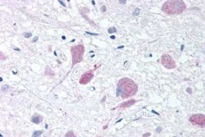 Immunohistochemistry-Paraffin: PLA2G3 Antibody - BSA Free [NB100-59031]