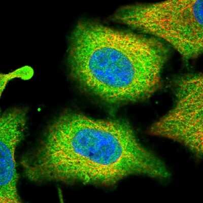 Immunocytochemistry/ Immunofluorescence: PLA2G4A Antibody [NBP2-38616]