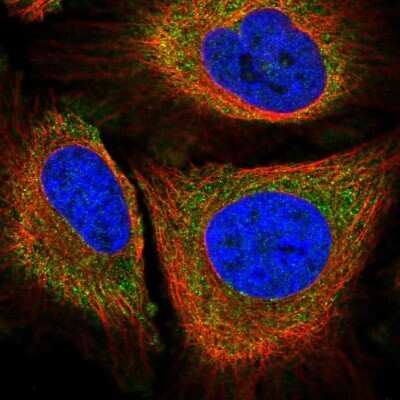 Immunocytochemistry/ Immunofluorescence: PLA2G4A Antibody [NBP2-38718]