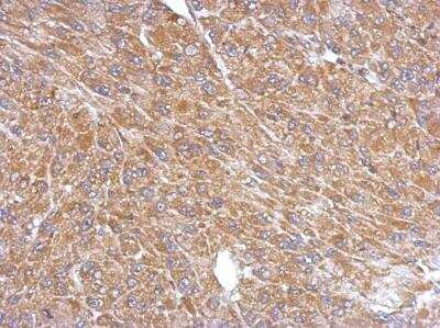 Immunohistochemistry-Paraffin: PLA2G4A Antibody [NBP1-31344]
