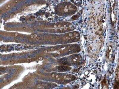 Immunohistochemistry-Paraffin: PLA2G4A Antibody [NBP1-31344]