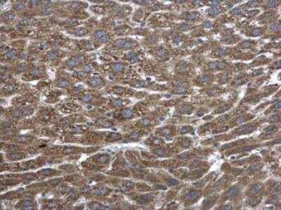 Immunohistochemistry-Paraffin: PLA2G4A Antibody [NBP1-31344]