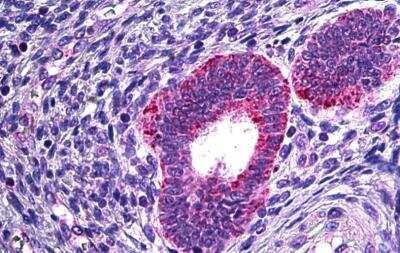 Immunohistochemistry-Paraffin: PLA2G4A Antibody [NBP1-52050]