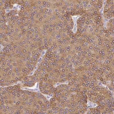 Immunohistochemistry-Paraffin: PLA2G4A Antibody [NBP2-38616]