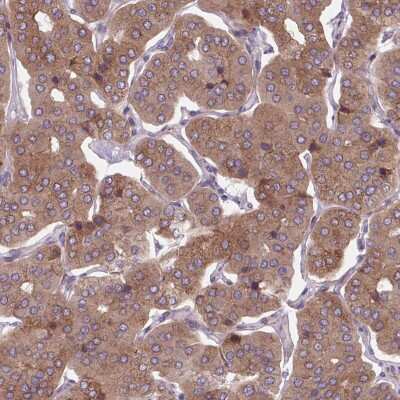 Immunohistochemistry-Paraffin: PLA2G4A Antibody [NBP2-38718]