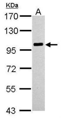 Western Blot: PLA2G4A Antibody [NBP1-31344]