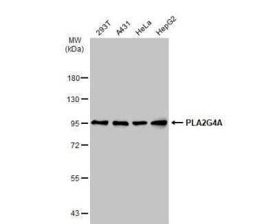 Western Blot: PLA2G4A Antibody [NBP1-31344]