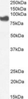 Western Blot: PLA2G4A Antibody [NBP1-52050]