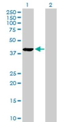 Western Blot: PLA2G4B Antibody [H00008681-D01P]