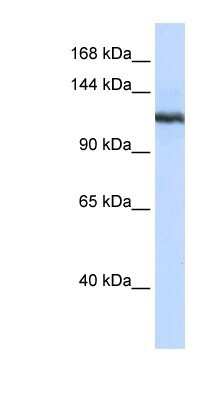 Western Blot: PLA2G4B Antibody [NBP1-80305]