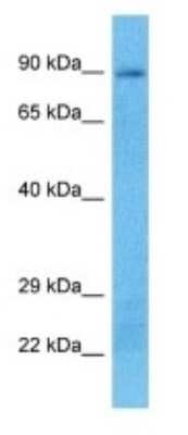 Western Blot: PLA2G4B Antibody [NBP3-09418]