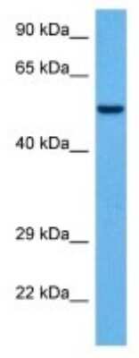 Western Blot: PLA2G4B Antibody [NBP3-10014]