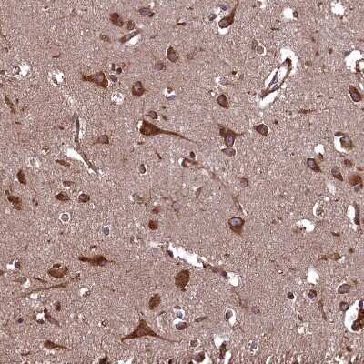 Immunohistochemistry-Paraffin: PLA2G4C Antibody [NBP1-85480]