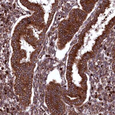 Immunohistochemistry-Paraffin: PLA2G4C Antibody [NBP1-85480]
