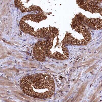 Immunohistochemistry-Paraffin: PLA2G4C Antibody [NBP1-85480]