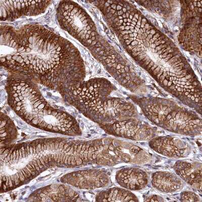 Immunohistochemistry-Paraffin: PLA2G4C Antibody [NBP1-85480]