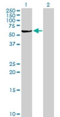 Western Blot: PLA2G4C Antibody [H00008605-B01P]