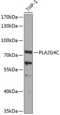 Western Blot: PLA2G4C AntibodyBSA Free [NBP2-93545]