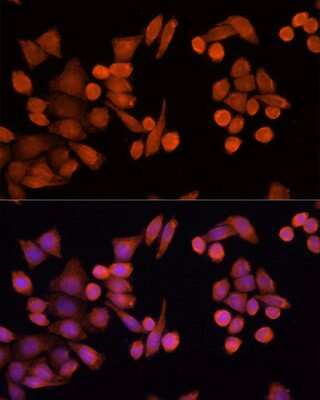 Immunocytochemistry/ Immunofluorescence: PLA2G4D Antibody - Azide and BSA Free [NBP3-05082]