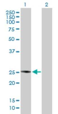 Western Blot: PLA2G4D Antibody [H00283748-B01P]