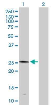 Western Blot: PLA2G4D Antibody [H00283748-D01P]