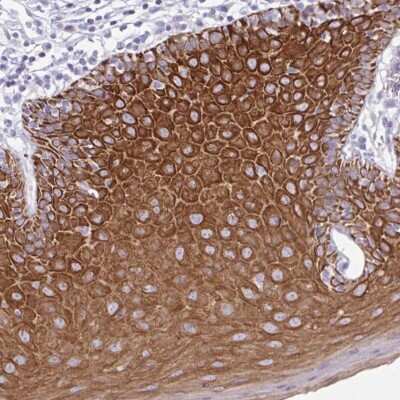 Immunohistochemistry: PLA2G4E Antibody [NBP2-32610]